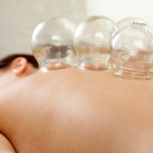 Cupping Services Renu